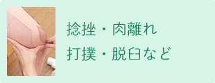 捻挫・肉離れ 打撲・脱臼など